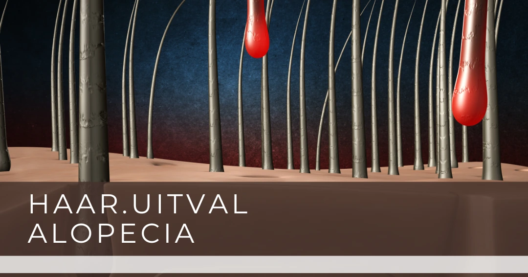 Androgenetische-Alopecia