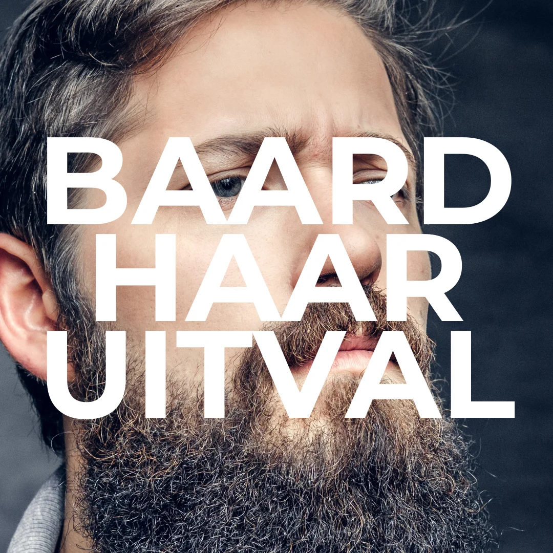 Baard-Haaruitval-Verminderen-klein