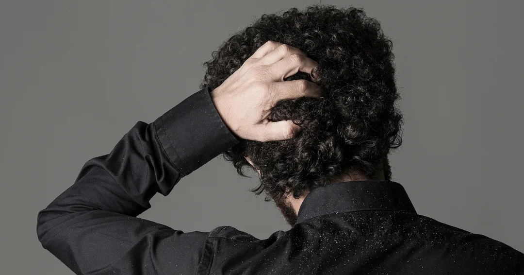 Alles wat je moet weten over roos: van oorzaken en symptomen tot behandelingen en natuurlijke remedies om roos effectief te bestrijden.