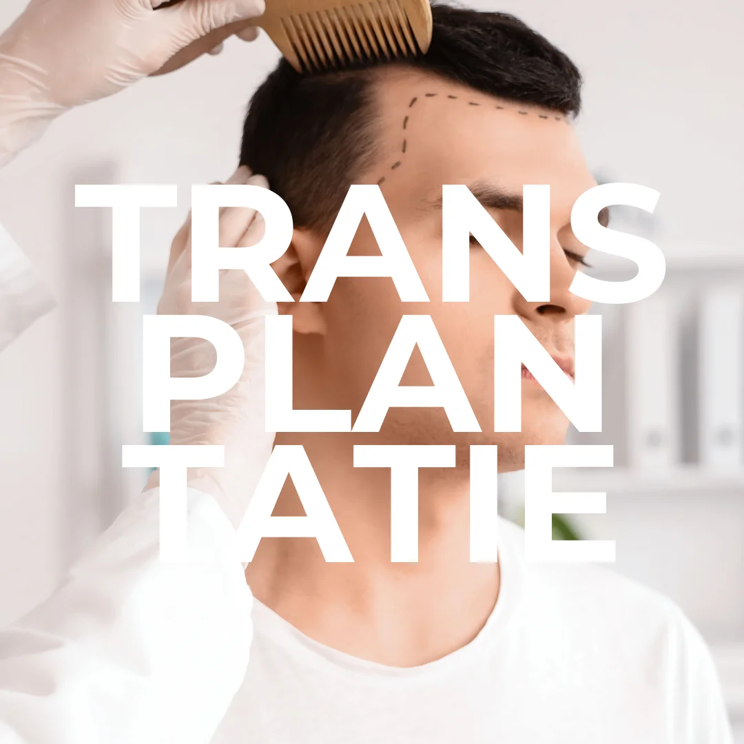haartransplantatie-voor-mannen-klein