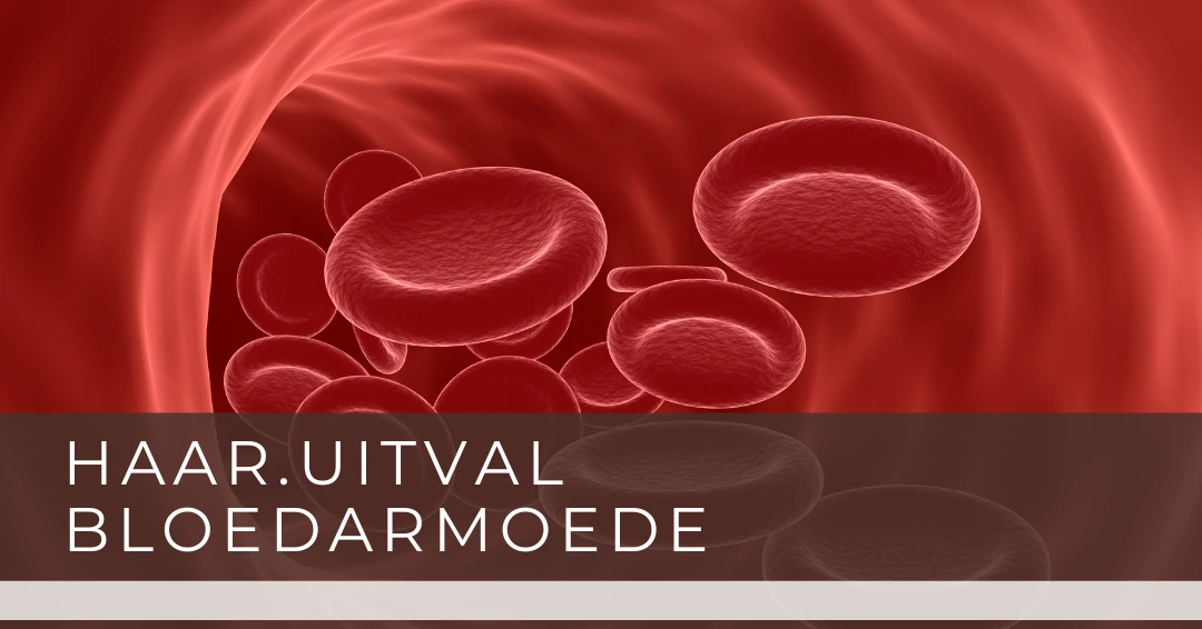 Haaruitval door bloedarmoede kan verontrustend zijn. Ontdek hier hoe bloedarmoede haaruitval veroorzaakt en wat je kunt doen om je haargroei te ondersteunen.