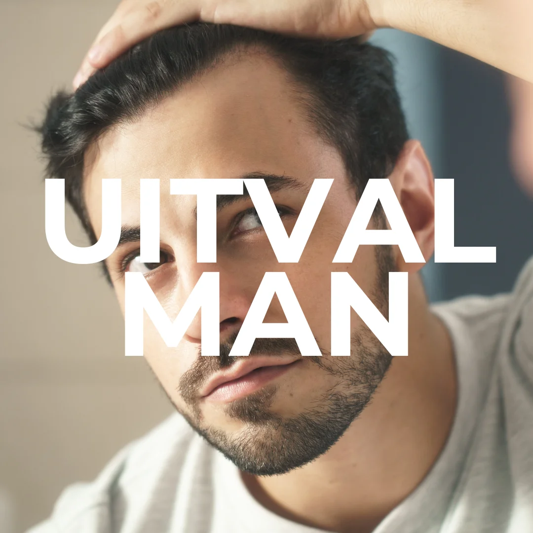 haaruitval-man-klein