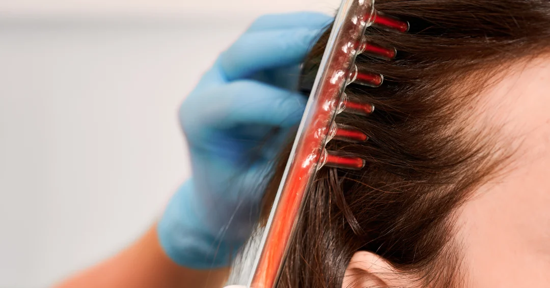 Laserbehandelingen voor haargroei: ontdek hoe LLLT haaruitval vertraagt, haardichtheid bevordert en een vollere haardos mogelijk maakt.